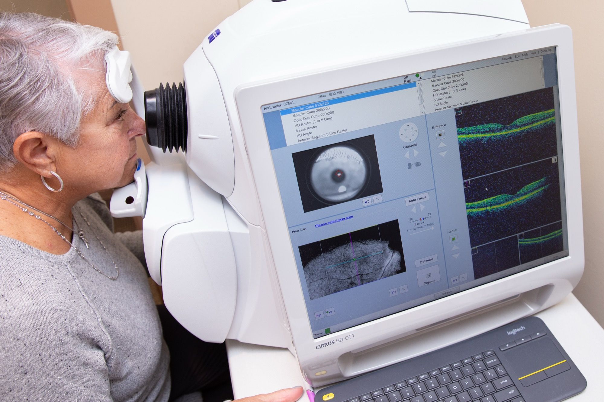 A patient at a retinal imaging device